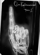 Стол Рентгена